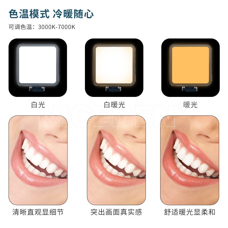 치과 사진 촬영용 LED 보조 조명, 휴대용 밝기 조절 - Photography Mobile Lighting 리뷰 및 가격