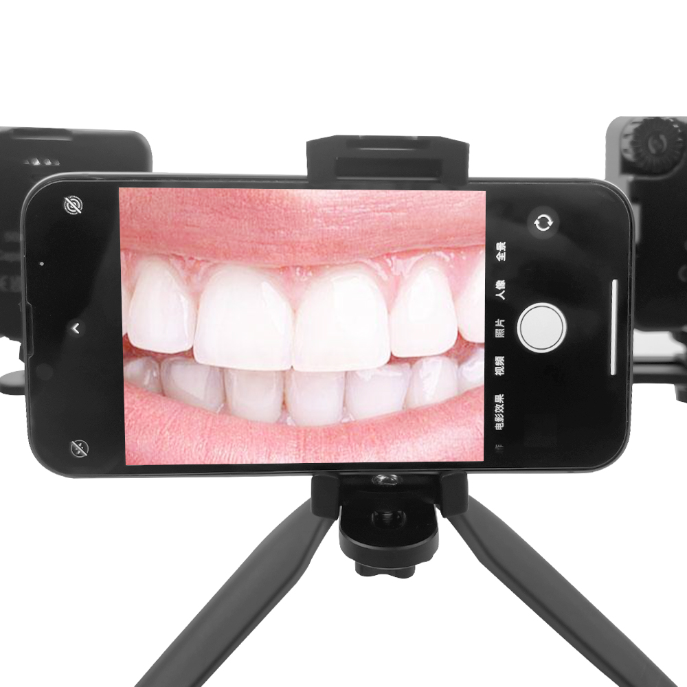 치과 사진 조명 구강 내 LED 구강 충전 램프 치과  - Photography Mobile Lighting 리뷰 및 가격